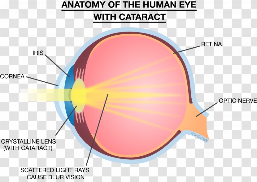 Light Eye Lens Strength Training Anatomy Cataract - Silhouette Transparent PNG