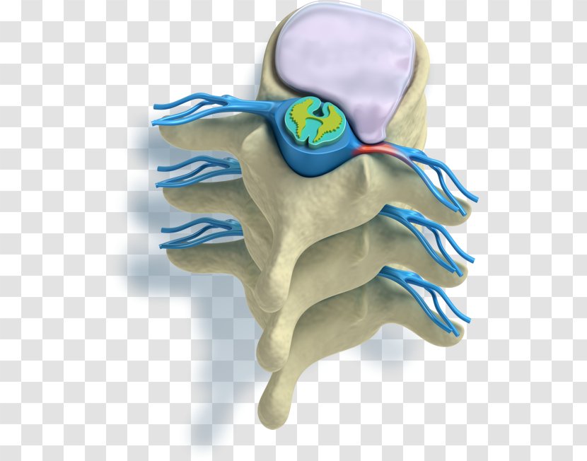 Pain In Spine Vertebral Column Spinal Disc Herniation Radicular Intervertebral - Watercolor - Cartoon Transparent PNG