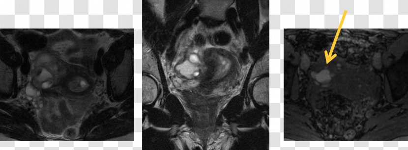 Radiology Medical Imaging Medicine White Magnetic Resonance - Cavernous Transparent PNG