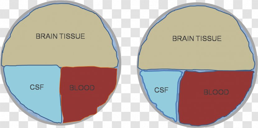 Central Nervous System Doktryna Monro-Kelliego Brain Skull - Area - Forensic Transparent PNG