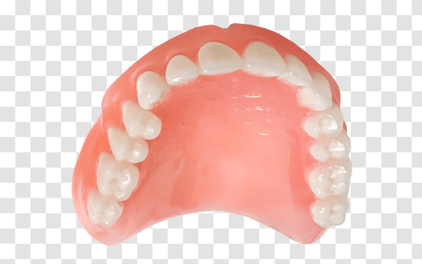 Tooth Dentures Implant Prosthesis Fixfogsor Rendelő - Spaıder Man Transparent PNG