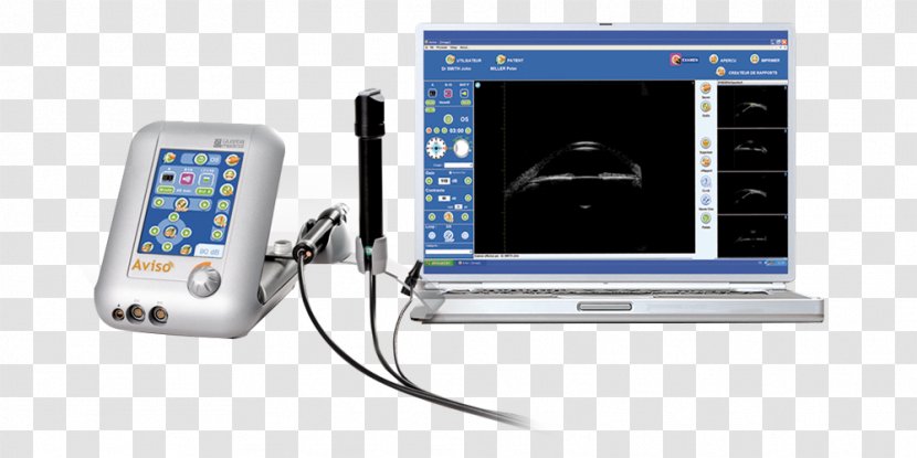 Ultrasonography Ophthalmology Medicine Ultrasound Medical Equipment - Electronics - Aviso Transparent PNG