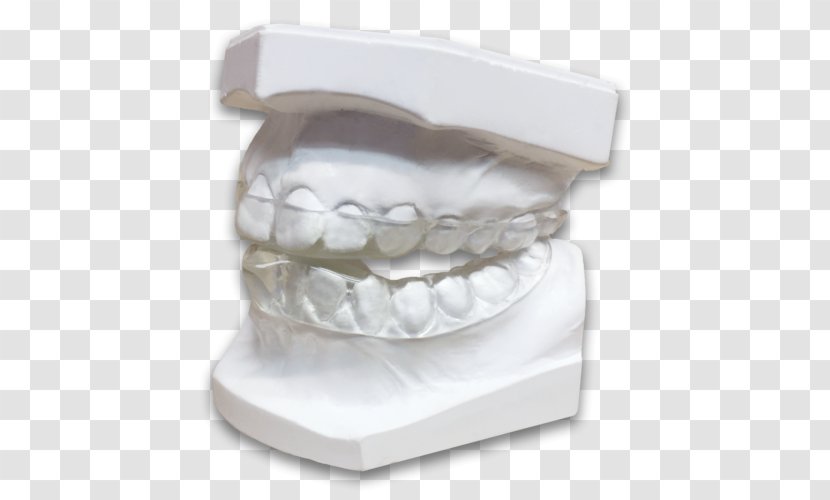 Jaw Tooth Bruxism Dentistry Splint - Occlusion - Dental Laboratory Transparent PNG