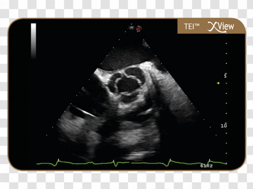 Radiology Skeletal Survey Ultrasonography Mylab Oy Positron Emission Tomography - Computer - Multimedia Transparent PNG