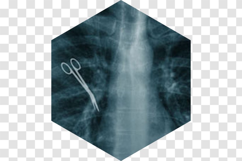 Medical Error Surgery Medicine Retained Surgical Instruments Health Care - Patient - Embarrassing Expression Transparent PNG