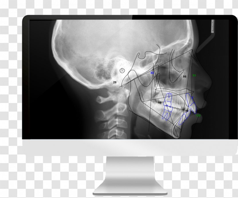 Medical Imaging Cone Beam Computed Tomography Radiography - Service Transparent PNG