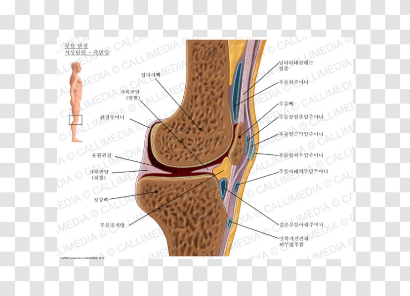 Prepatellar Bursitis Synovial Bursa Infrapatellar Knee - Watercolor - Artrosis De Rodilla Transparent PNG