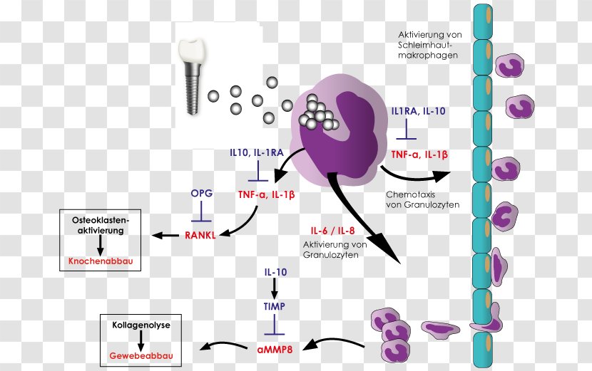 Inflammation Cytokine Peri-implantitis Immune System Interleukin - Tree - Watercolor Transparent PNG