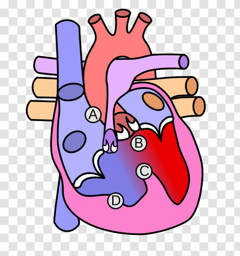 Congenital Heart Defect Aortic Valve Diagram Anatomy - Silhouette Transparent PNG