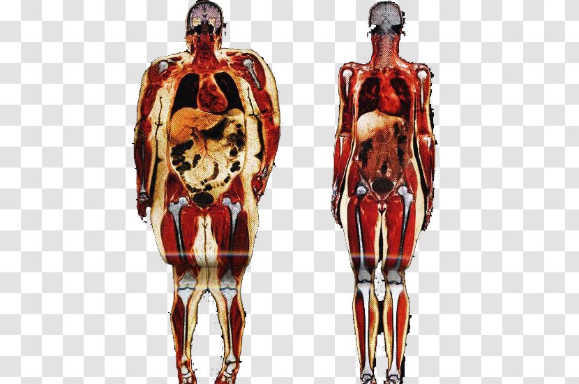 Obesity Human Body Adipose Tissue Anatomy Connective - Frame - Health Transparent PNG