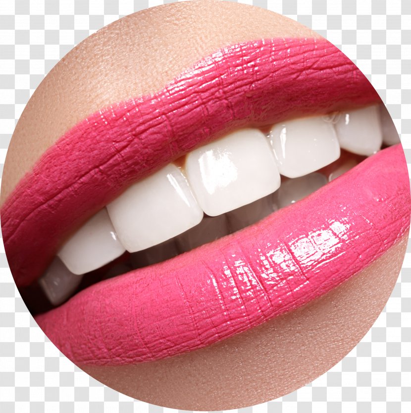 Tooth Whitening Dentistry Dental Braces - Human - Toothpaste Transparent PNG
