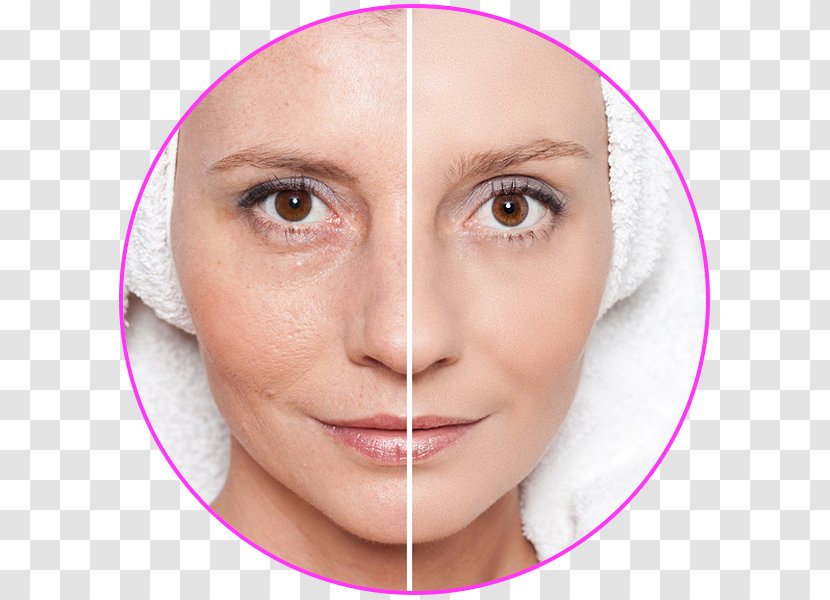 Geria Dermatology: Aanand Geria, MD Laser & Aesthetics Studio Of Winter Park Azul Med Spa Skin Care Anti-aging Cream - Cheek - Chemical Peel Transparent PNG