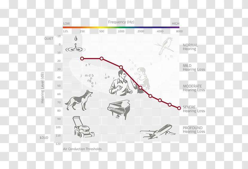 Cochlear Implant Audiometry Audiogram MED-EL Hearing Loss - Audiologist - Ear Transparent PNG