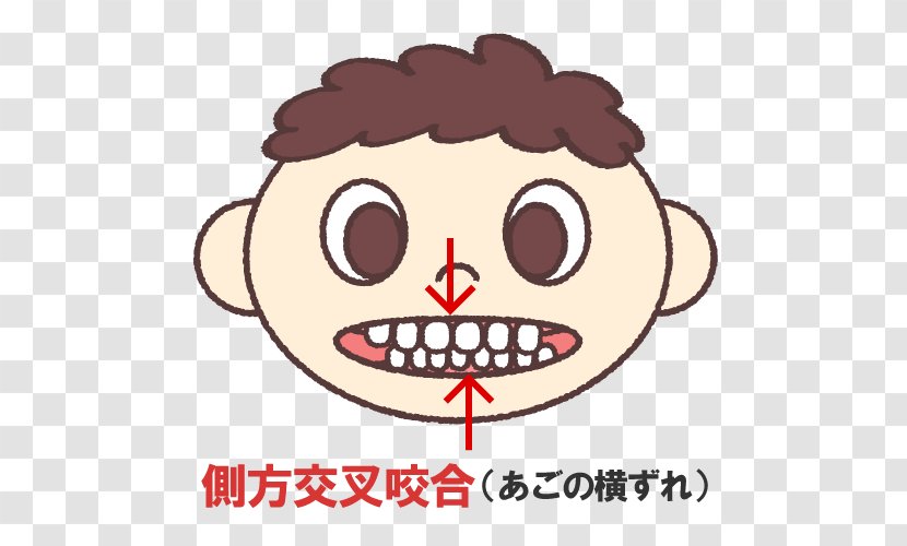 矯正歯科 Dentistry Prognathism - Face - Captions Transparent PNG