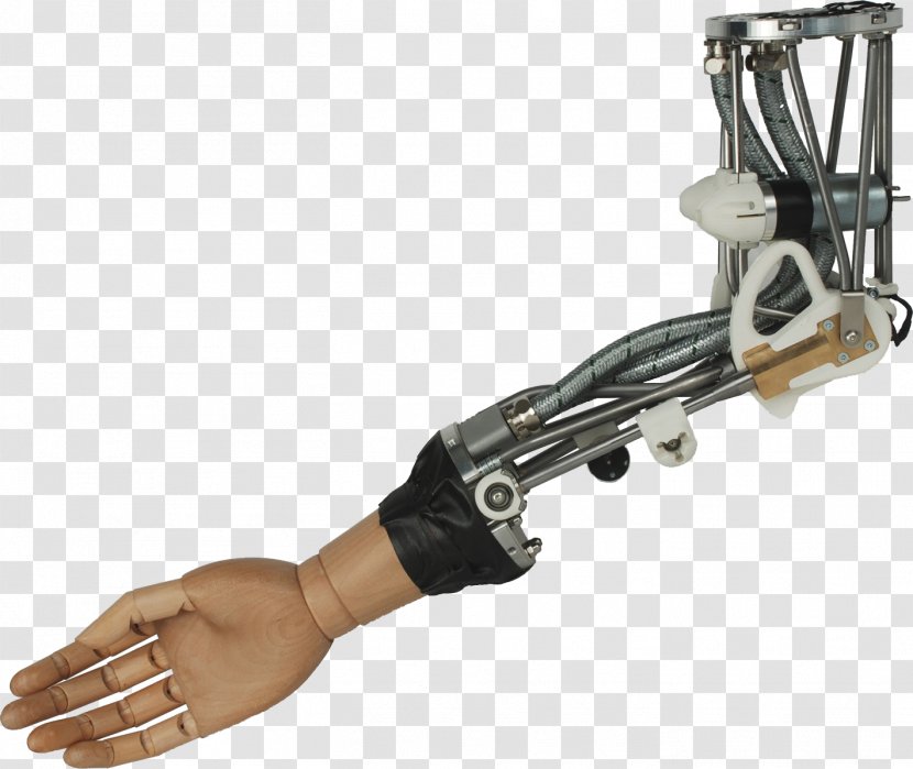 Robotic Arm Prosthesis Bionics - Articulated Robot - Prosthetic Hand Transparent PNG