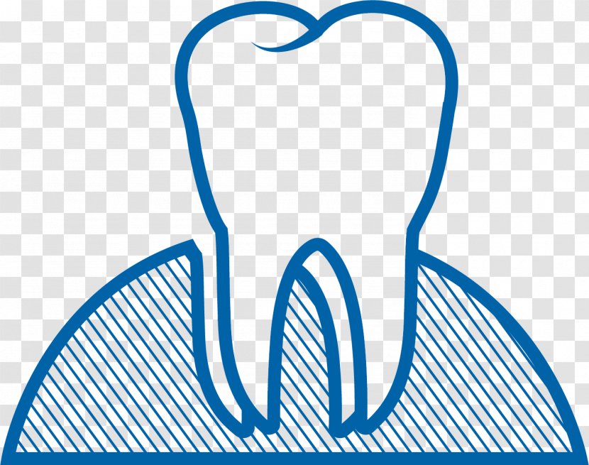 Dental Surgery Extraction Wisdom Tooth Implant - Surgeon Transparent PNG