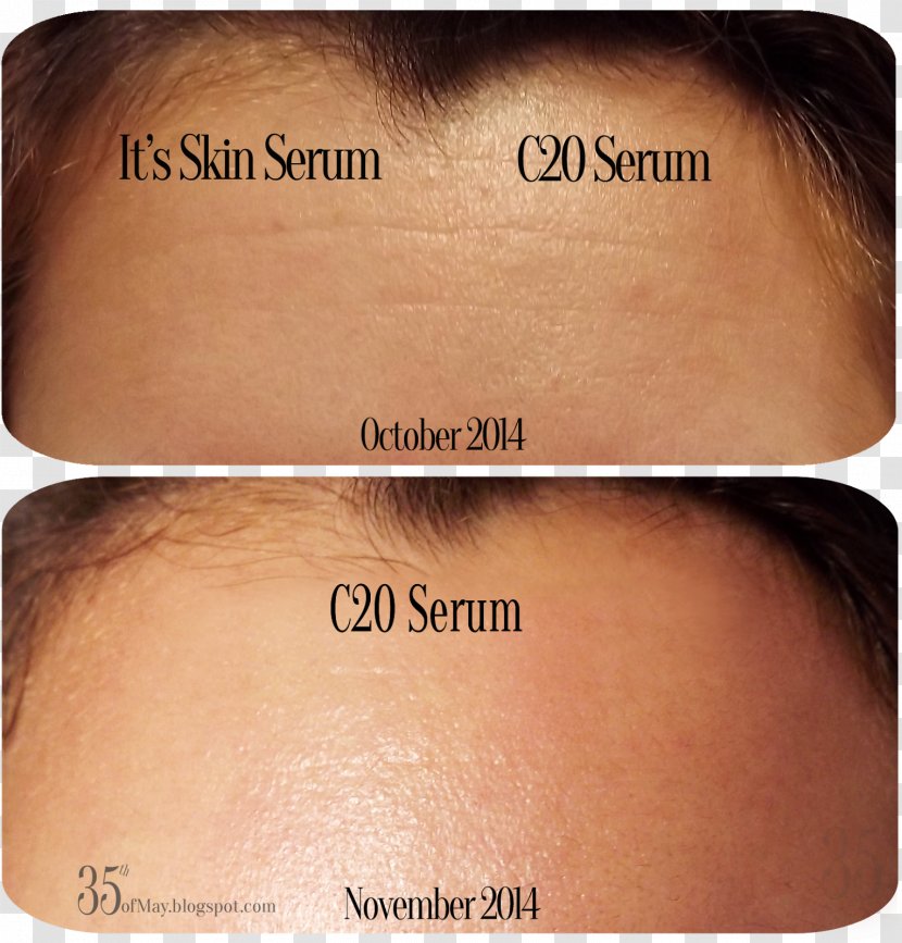 Wrinkle Vitamin C Serum Skin - Cheek - Glow Effect Transparent PNG