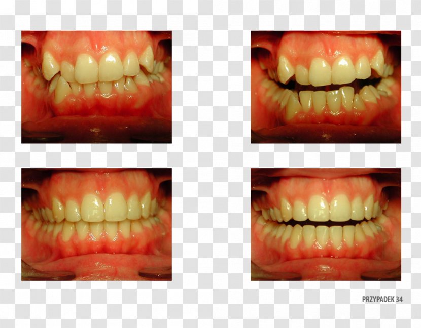 Tooth Orange Polska Close-up Therapy - Mouth Transparent PNG