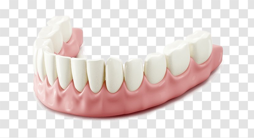 Tooth Alveoloplasty Dentistry Dental Extraction Dentures - Matter - Gingival Bleeding Transparent PNG