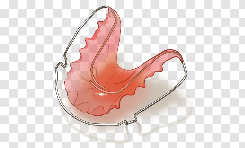 Dental Braces Dentistry 矯正歯科 Dentition - Watercolor - Retainer Transparent PNG