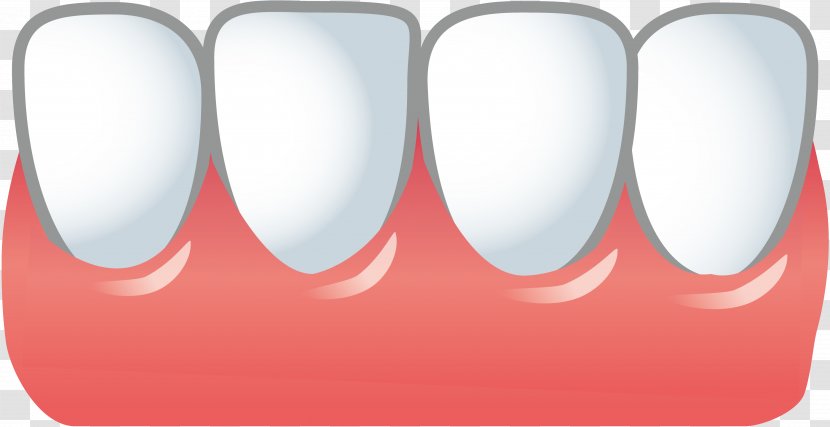 Tooth Decay Periodontal Disease Dentist Therapy Transparent PNG