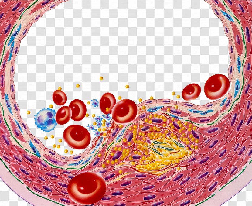Low-density Lipoprotein Arteriosclerosis Platelet Illustration - Watercolor - Blood Lipid Cell Transparent PNG