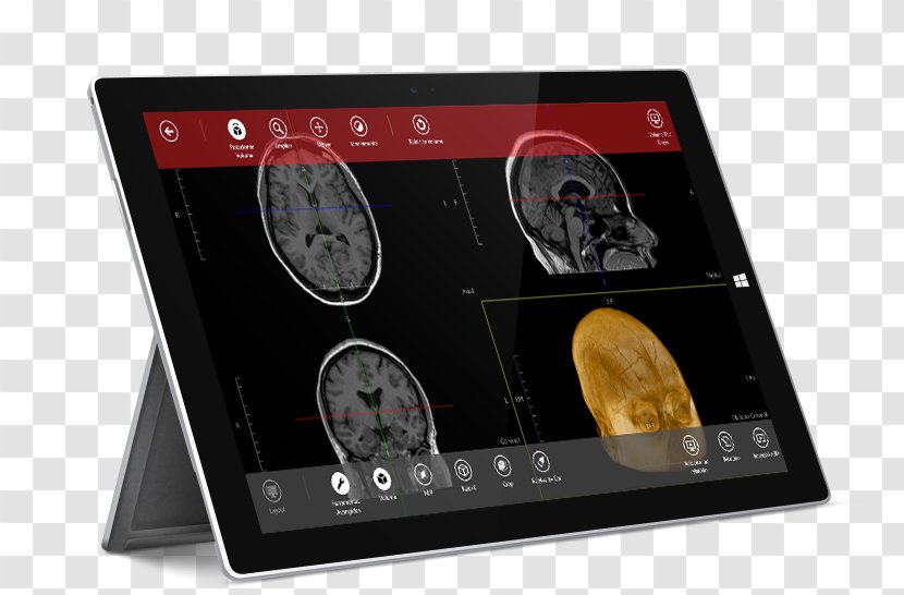 Laptop 3D Reconstruction Electronics Navegatium Inc. Aortic Aneurysm - Computer Hardware Transparent PNG