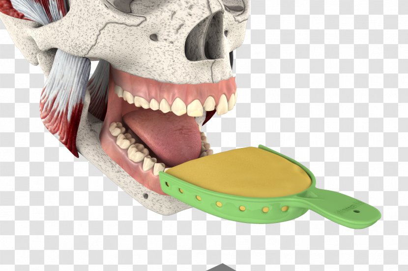 Jaw - Mouth - 3d Tooth Repair Transparent PNG