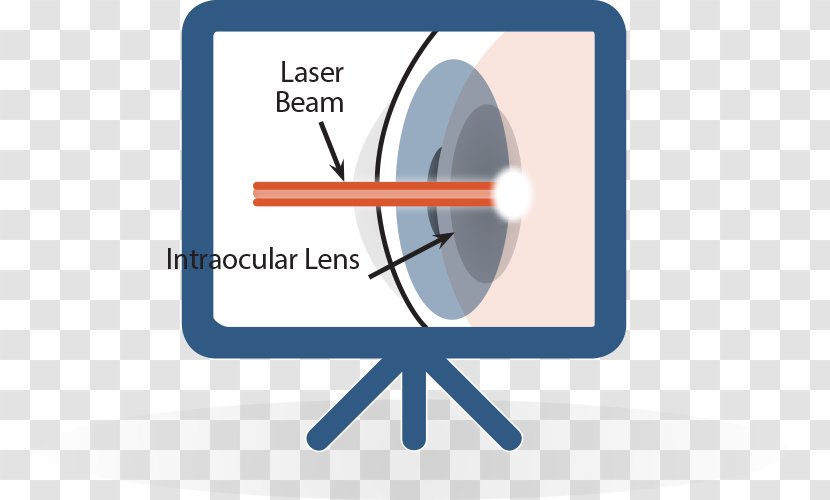 Cataract Surgery Laser Lens - Beam Transparent PNG