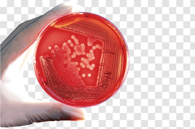 Bacteria Plate Count Agar Cell - Red - Prevent Infection Transparent PNG