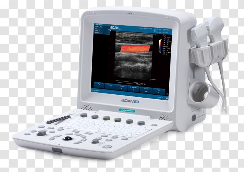 Edan USA Diagnostic Ultrasound Ultrasonography Medical Imaging - Obstetrics And Gynaecology - Sonosim Transparent PNG