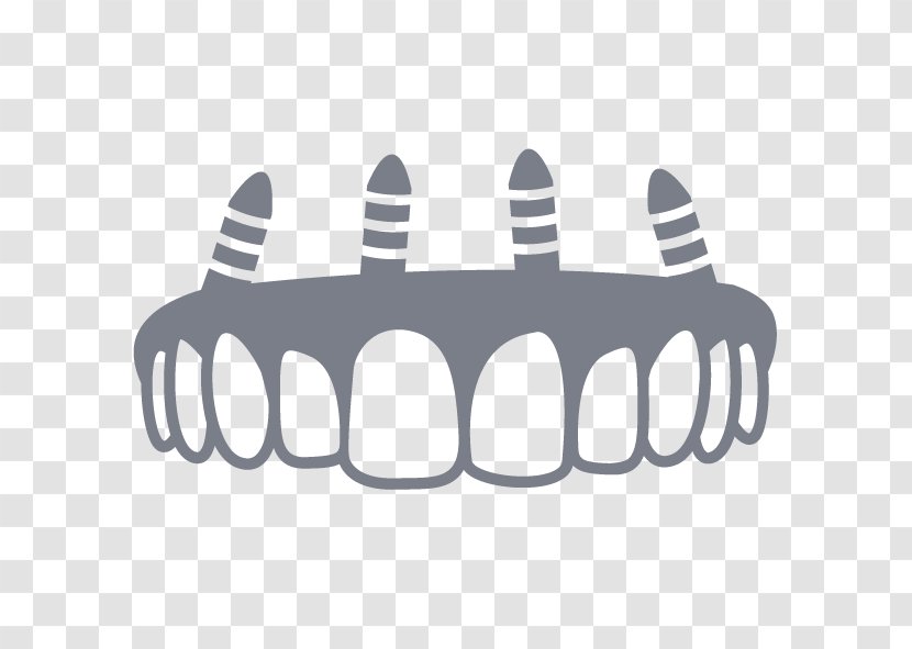 Dentistry Dental Implant All-on-4 Tooth - Crown Transparent PNG