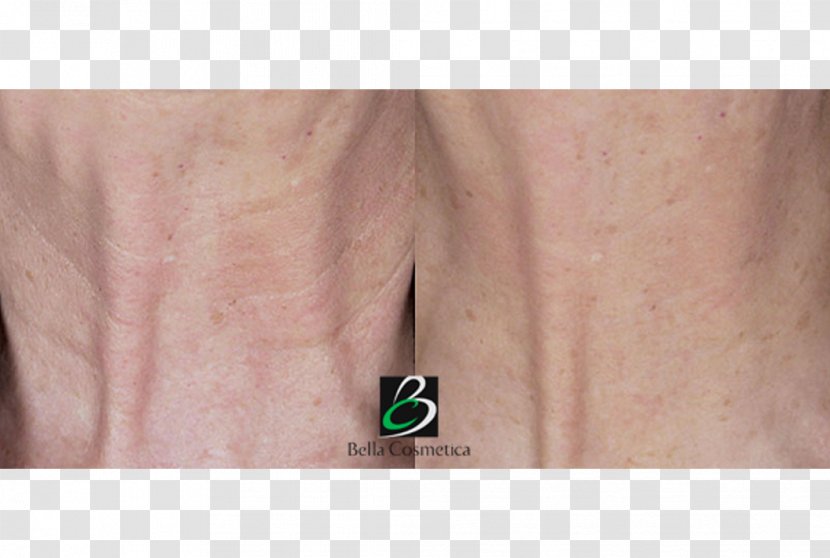 Neck Wrinkle Skin Hair Removal Cosmetics - Face Transparent PNG