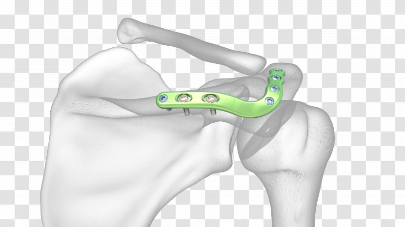 Thumb Acromion Shoulder Joint Scapula - Cartoon - Fracture Definition Transparent PNG