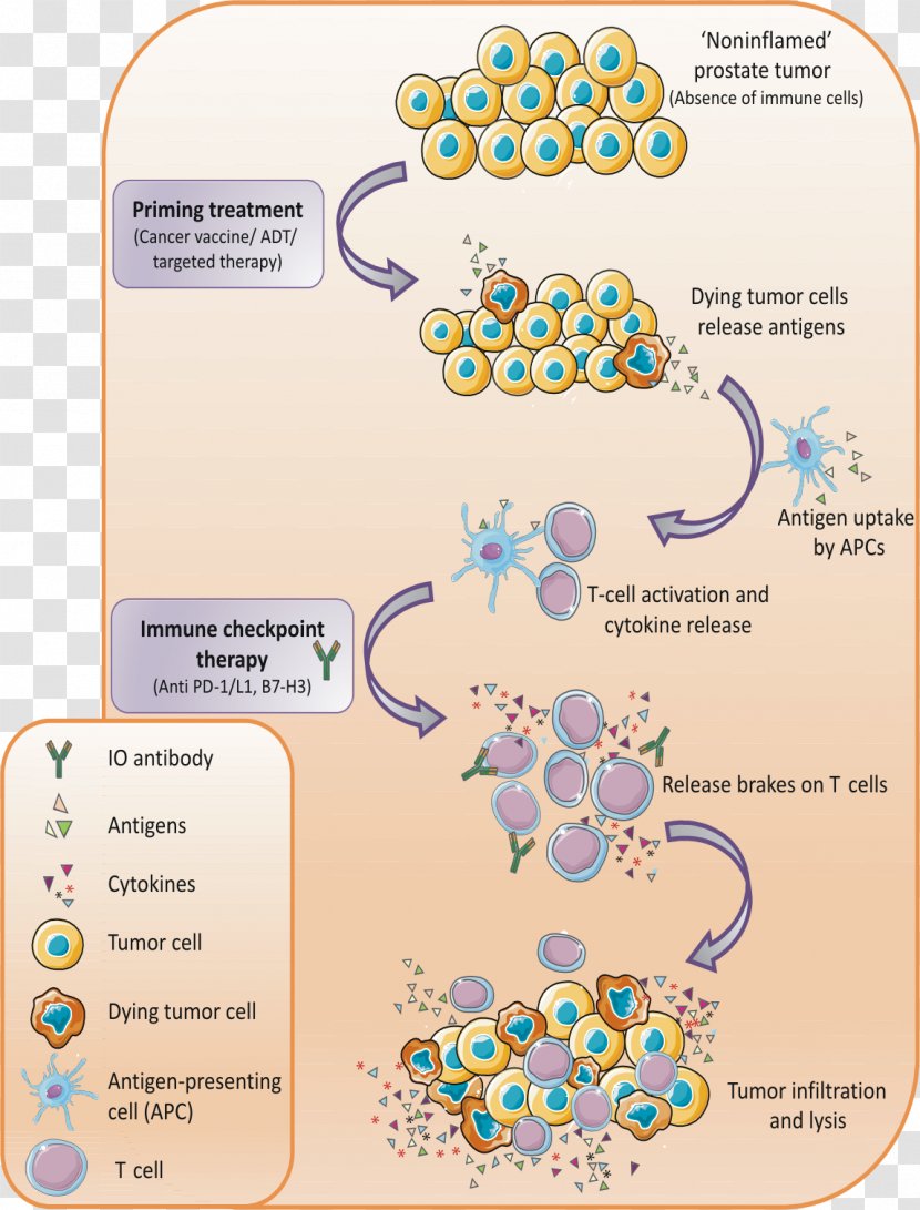 Prostate Cancer Checkpoint Inhibitor Therapy Immune Abiraterone Acetate - Organism Transparent PNG