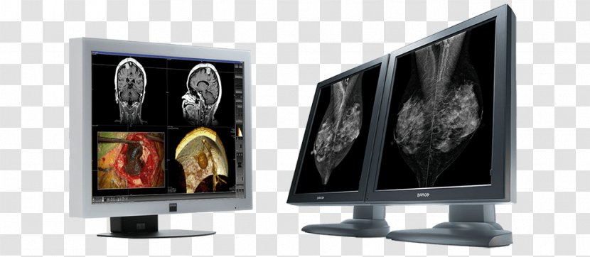 LCD Television Computer Monitors Liquid-crystal Display Barco Coronis 5MP IPS Panel - Multimonitor Transparent PNG