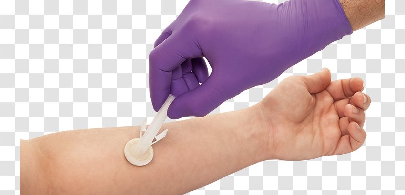 Milliliter CareFusion Becton Dickinson Vial Celebrity - Arm - Prevent Infection Transparent PNG