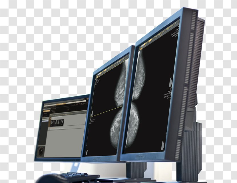 Computer Monitors Hardware Doctor Of Medicine Health Technology - Medical Diagnosis Transparent PNG