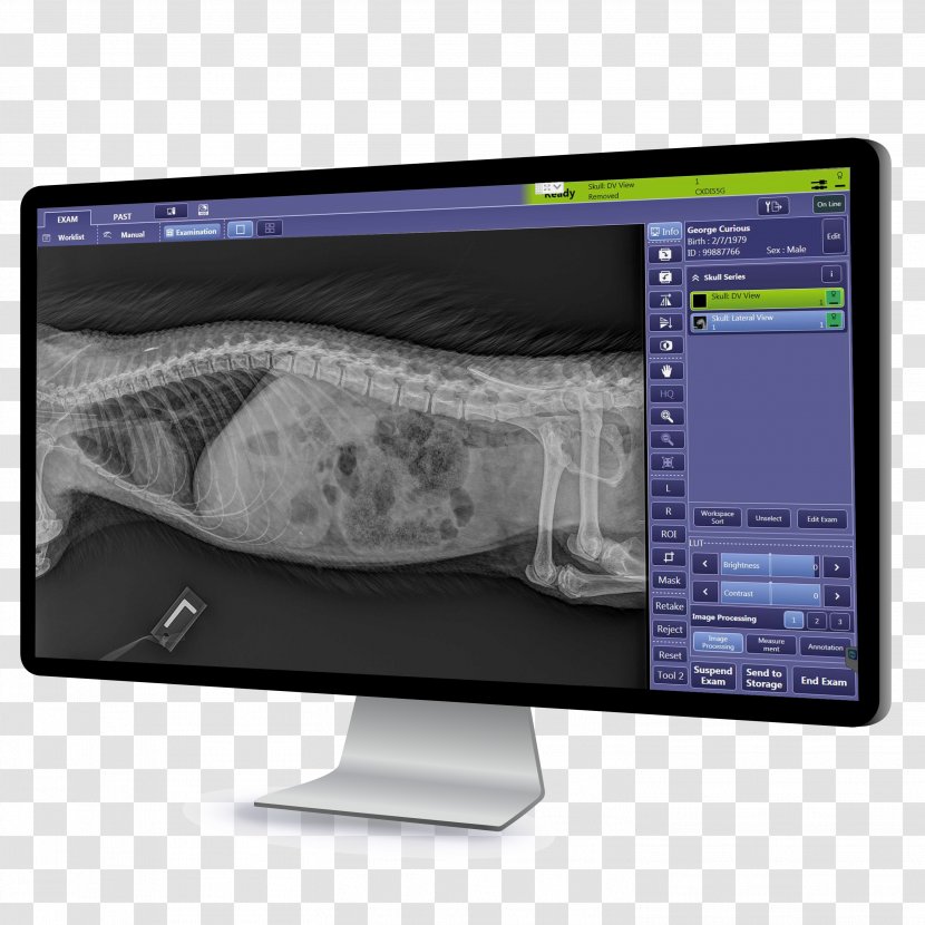 Digital Radiography Canon Medical Systems Corporation Computer Monitors Imaging - Monitor - Porcupine Transparent PNG