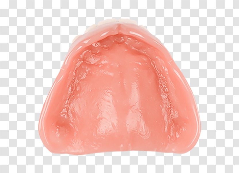 Aspen Dental Dentures Dentistry Lip - Tissue - Acrylic Fiber Transparent PNG