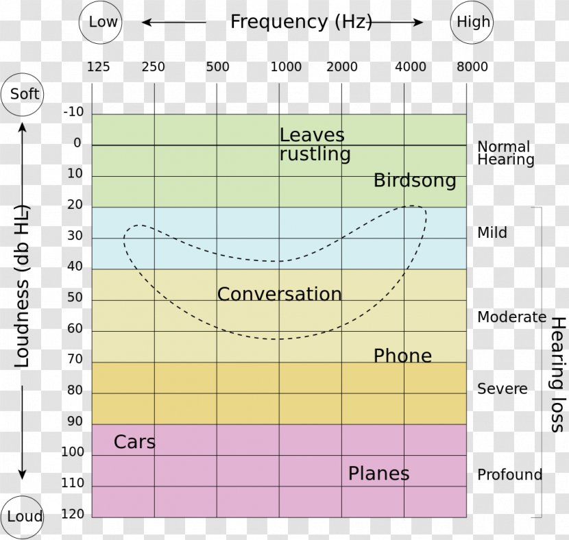 Hearing Loss Range Test Audiogram - Text - Ear Transparent PNG