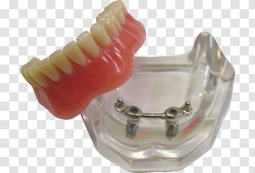 Tooth Mandible Dentures Jaw Anatomy - Skull Transparent PNG