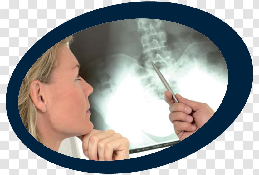 Densitometria òssia Osteoporosis Bone Density Densitometry - Mouth - Broken Transparent PNG