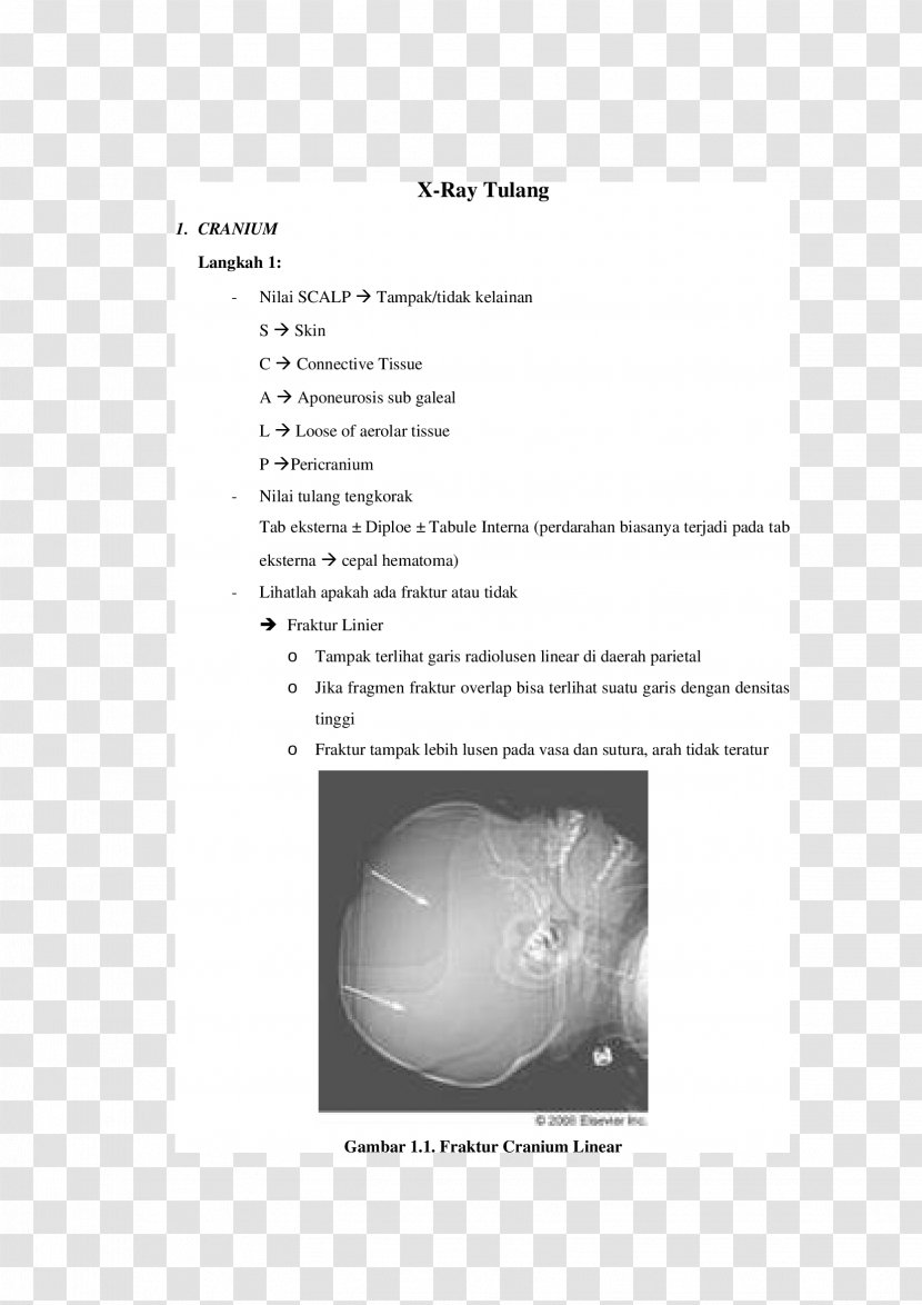 Joint Skull Fracture - Design Transparent PNG