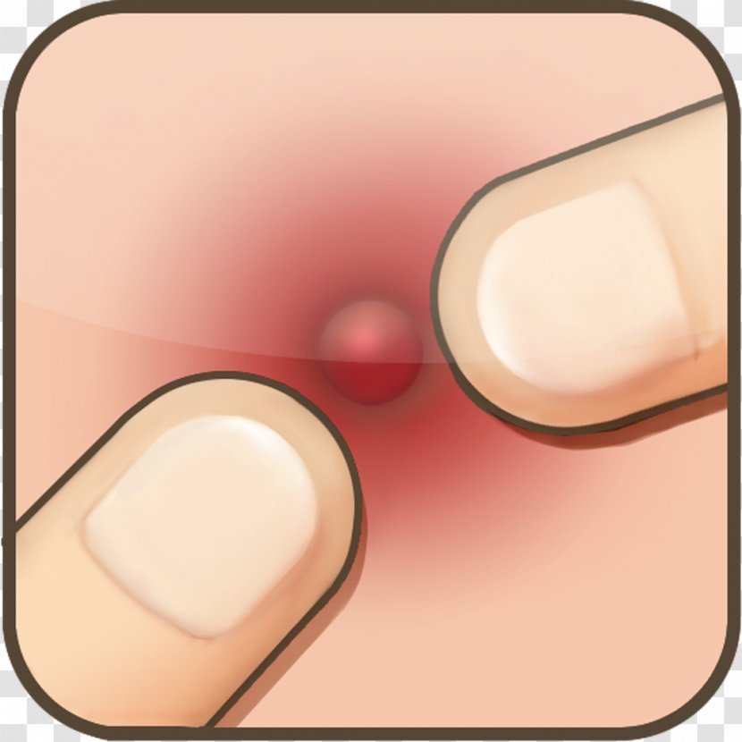Pimple Acne Kindle Fire App Store Flappy Bird - Peach Transparent PNG