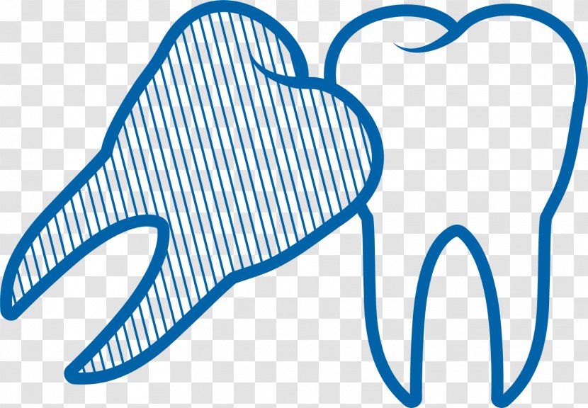 Arizona Dental Surgery Human Tooth Extraction Wisdom - Heart Transparent PNG