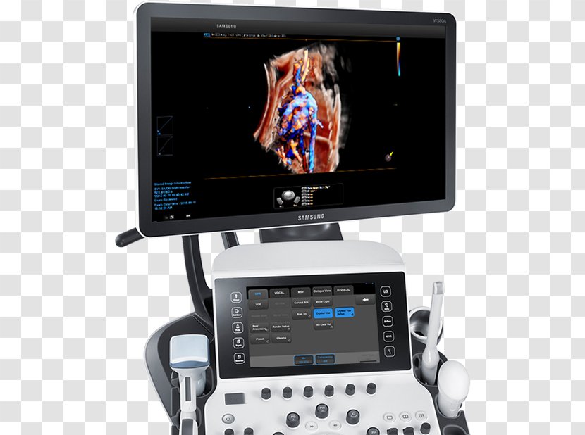 Ultrasonography Ultrasound Obstetrics And Gynaecology Radiology Medical Diagnosis - Ob Gyn Pics Transparent PNG