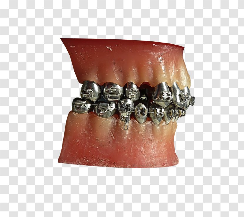 Human Tooth Metal Jaw DeviantArt - Deviantart - Steel Teeth Collection Transparent PNG