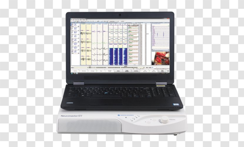 Netbook Laptop Computer Hardware Personal Monitors - Multimedia Transparent PNG
