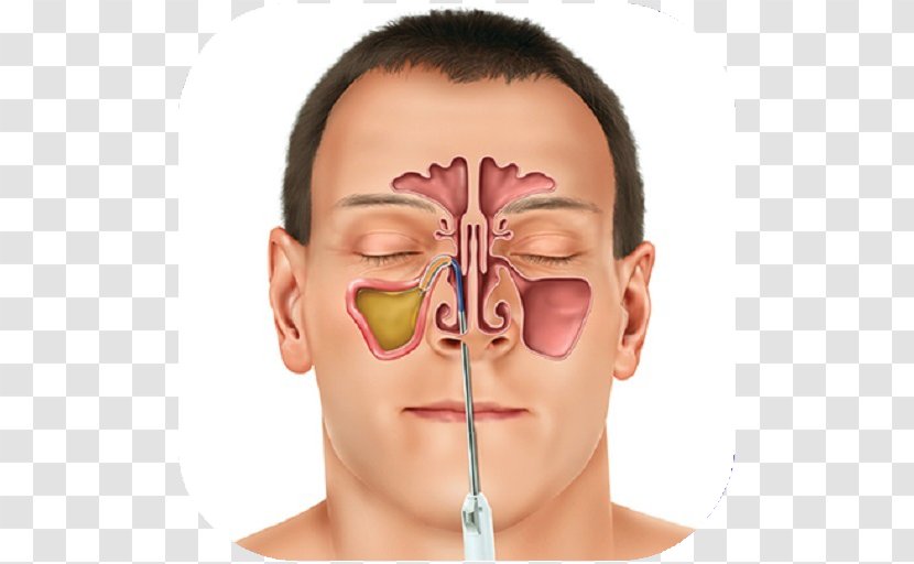 Sinus Infection Paranasal Sinuses Therapy Toothache - Head - Health Transparent PNG